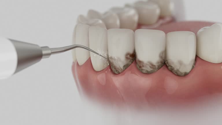 Reliable Dental Implants contractor in Niles, IL by Smile Center Dentistry